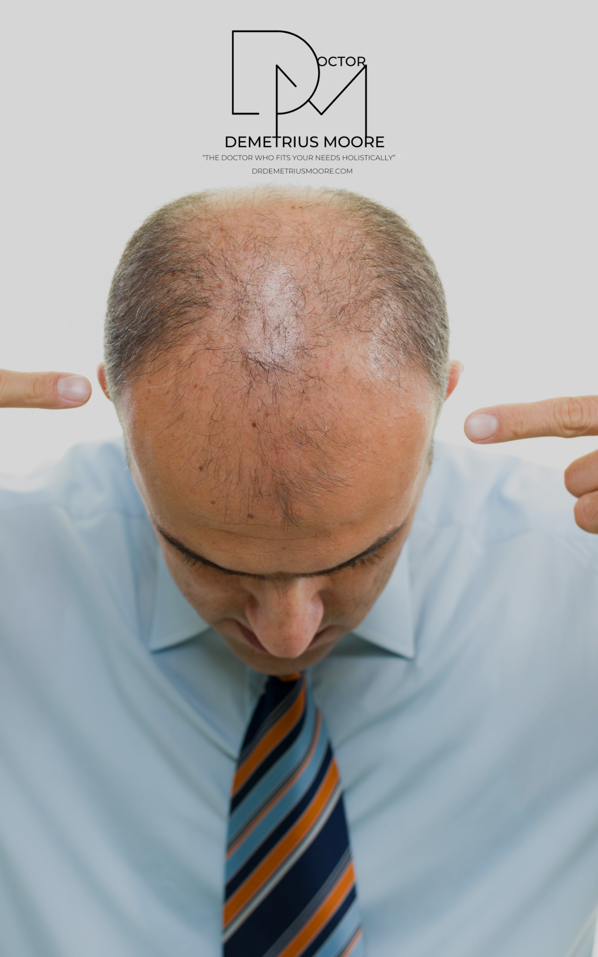 Natural Hair Loss Specialist Near Me in Alpharetta, Fayetteville, Grayson, Lawrenceville, Peachtree City, Roswell, and Snellville, GA 